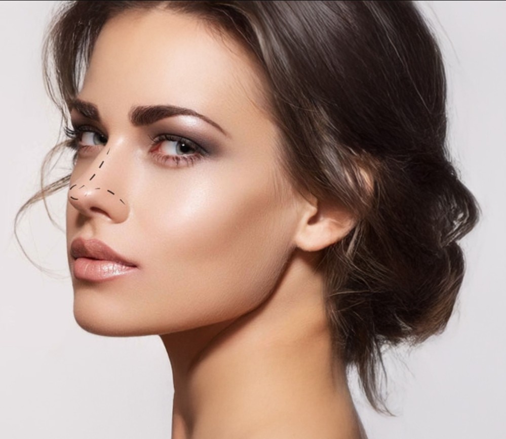 Kayseri estetik klinik