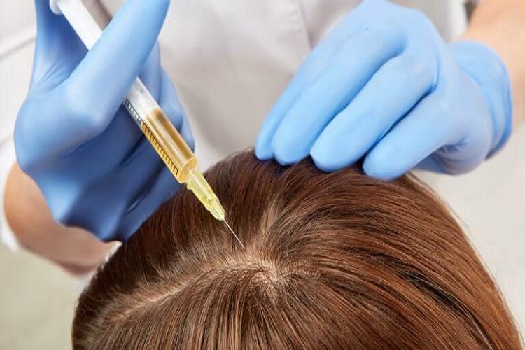 Ankara Saç Kök Hücre Tedavisi